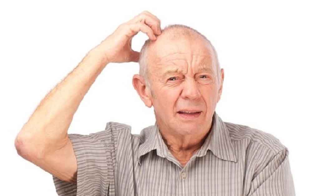 Alzheimer’s Disease - What You Need To Know